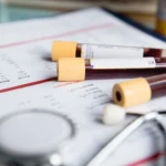 Пробірка з кров'ю для аналізу на аутоімунні захворювання в лабораторії